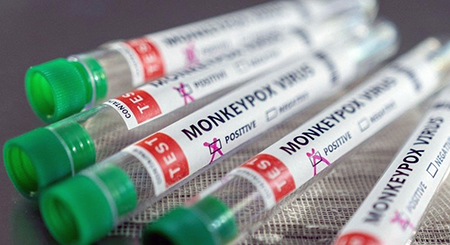 Leia mais sobre o artigo 1º caso da Varíola do Macaco é confirmado em SP