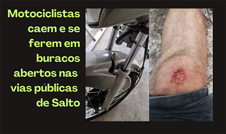 Leia mais sobre o artigo 2 motociclistas ficam feridos após caírem em buracos abertos há meses em Salto