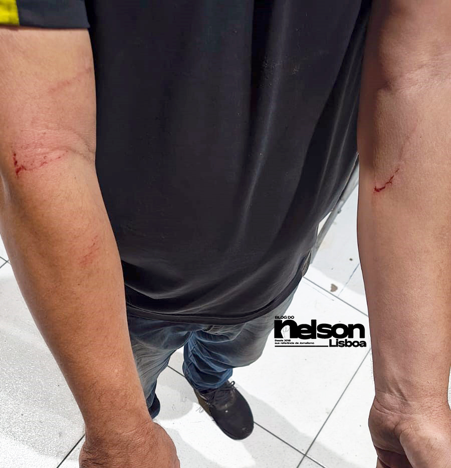 Homem ferido por pedras jogadas por pessoa em sofrimento mental em Salto